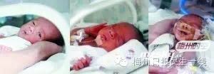 在广医三院出生的三胞胎宝宝.jpg